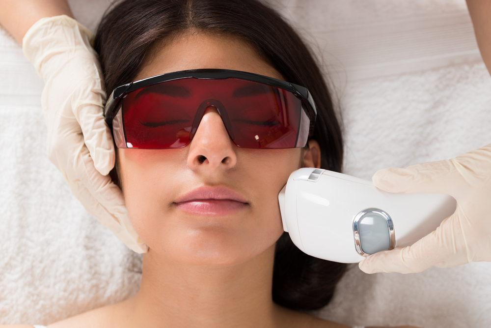 Woman getting laser hair removal on her face in NYC