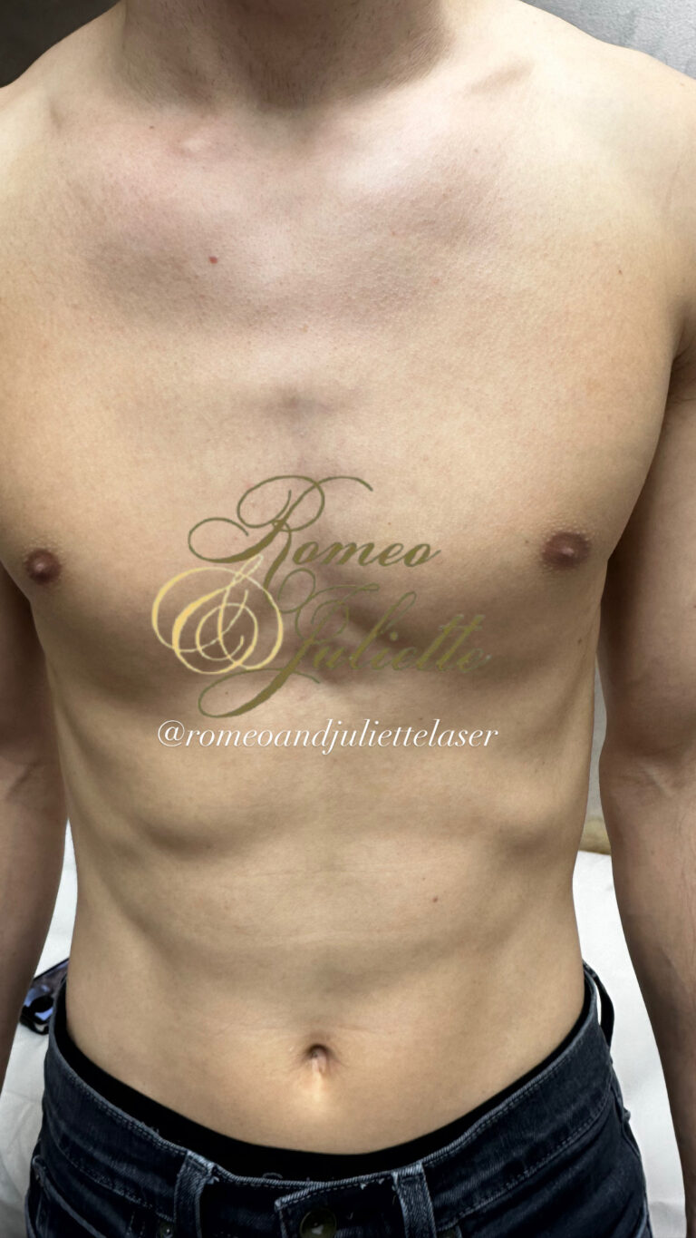 After Image: Male Chest - front